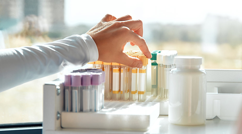 How Often Should You Get Bloodwork Done?